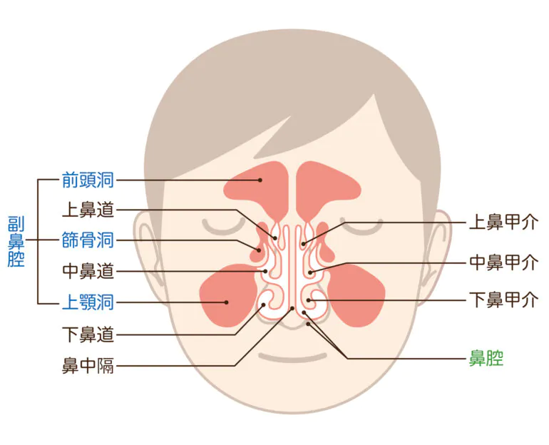 副鼻腔炎（蓄膿症）